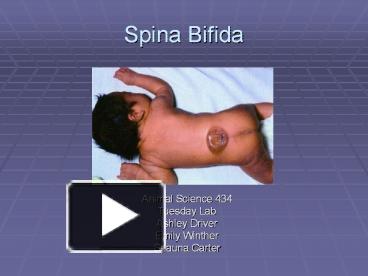 spina bifida occulta dimple