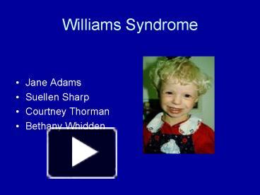 PPT – Williams Syndrome PowerPoint Presentation | Free To View - Id ...