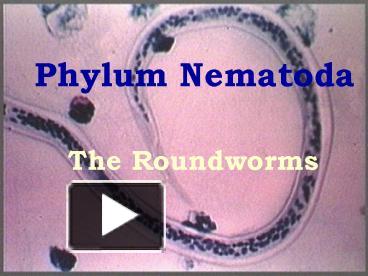 PPT – Phylum Nematoda PowerPoint Presentation | Free To View - Id ...