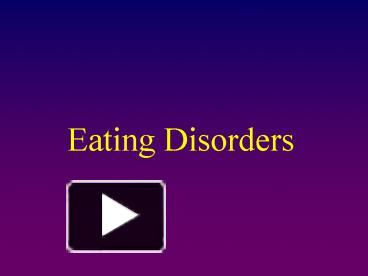 PPT – Eating Disorders PowerPoint Presentation | Free To View - Id ...