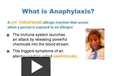 PPT – What Is Anaphylaxis? PowerPoint Presentation | Free To View - Id ...