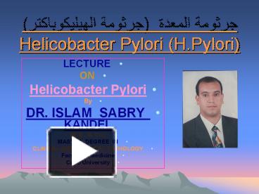 PPT – ?????? ?????? (?????? ?????????????) Helicobacter Pylori (H ...