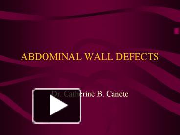 PPT – ABDOMINAL WALL DEFECTS PowerPoint Presentation | Free To Download ...