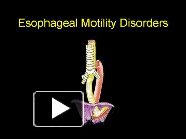 PPT – Esophageal Motility Disorders PowerPoint Presentation | Free To ...