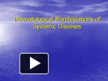 PPT – Dermatological Manifestations Of Systemic Diseases Skin ...