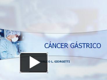 PPT – Gastric Cancer PowerPoint Presentation | Free To Download - Id ...