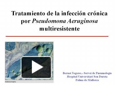 PPT – Tratamiento De La Infecci PowerPoint Presentation | Free To ...