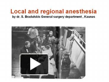 PPT – Local And Regional Anesthesia By Dr. S. Bradulskis General ...