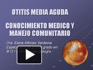 Ppt Otitis Media Aguda Powerpoint Presentation Free To Download Id Cd Da Zmi Z