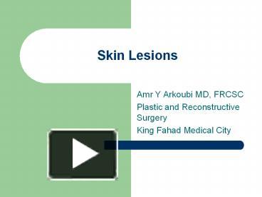 PPT – Skin Lesions PowerPoint Presentation | Free To View - Id: 3e1daf ...