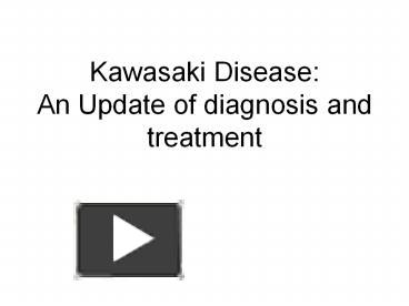 PPT – Kawasaki Disease: An Update Of Diagnosis And Treatment PowerPoint ...