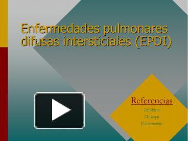 PPT Enfermedades Pulmonares Difusas Intersticiales EPDI PowerPoint