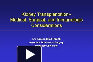 PPT – Kidney Transplantation PowerPoint Presentation | Free To View ...