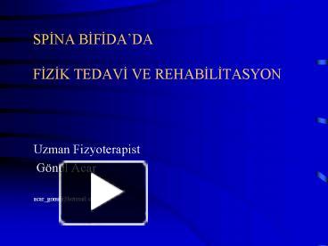 PPT SPINA BIFIDA PowerPoint Presentation Free To View Id 4736af