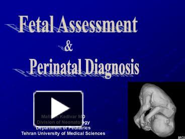 PPT – Fetal Assessment PowerPoint Presentation | Free To View - Id ...