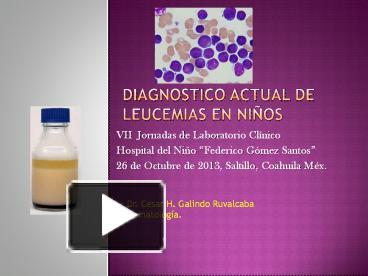 Ppt Diagnostico Actual En Leucemia Aguda En Ni Os Powerpoint Presentation Free To Download