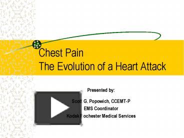 PPT – Chest Pain The Evolution Of A Heart Attack PowerPoint ...