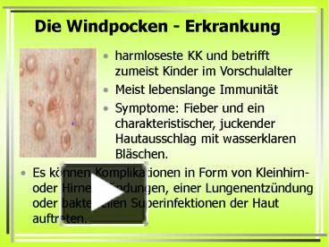 PPT – Die Windpocken - Erkrankung PowerPoint Presentation | Free To ...