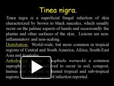 Tinea Nigra // Microbiology 