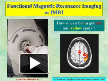 PPT – Functional Magnetic Resonance Imaging Or FMRI PowerPoint ...