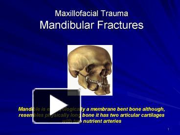 PPT Maxillofacial Trauma Mandibular Fractures PowerPoint Presentation Free To View Id