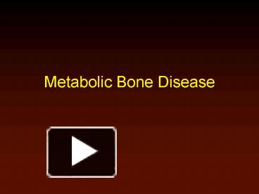 Ppt Metabolic Bone Disease Powerpoint Presentation Free To View