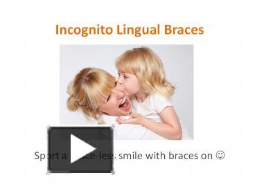 Ppt Incognito Lingual Braces Powerpoint Presentation Free To