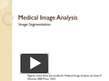 PPT – Medical Image Analysis PowerPoint Presentation | Free To Download ...