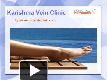 Ppt Varicose Vein Treatment Clinic In Pune Karishma Vein Clinic