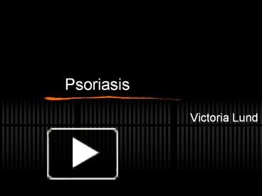 Ppt Psoriasis Powerpoint Presentation Free To Download Id A Nwjhy