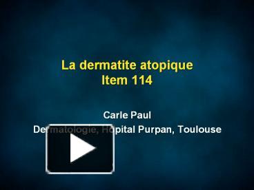 PPT – La Dermatite Atopique Item 114 PowerPoint Presentation | Free To ...