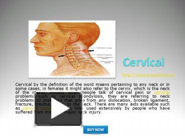 Ppt – Cervical Collar Powerpoint Presentation 