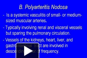 PPT – B. Polyarteritis Nodosa PowerPoint Presentation | Free To ...