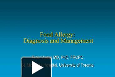 PPT – Food Allergy: Diagnosis And Management PowerPoint Presentation ...