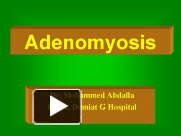 PPT - Dr. Mohammed Abdalla Egypt, Domiat general hospital PowerPoint  Presentation - ID:5687329