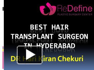 Ppt Best Hair Transplantation Clinic In Hyderabad Powerpoint