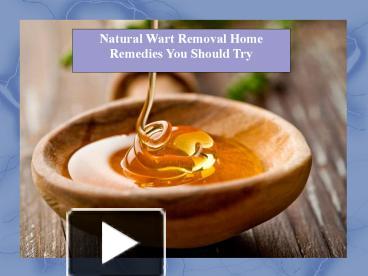 PPT – Natural Wart Removal Home Remedies You Should Try PowerPoint ...