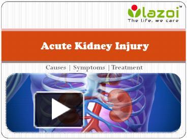 PPT – Acute Kidney Injury PowerPoint Presentation | Free To Download ...