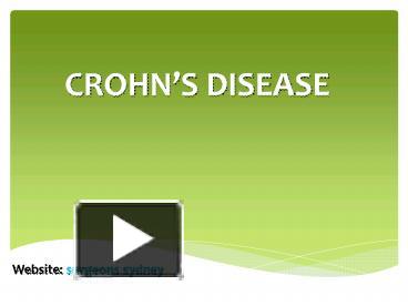 PPT – Crohns Disease PowerPoint Presentation | Free To Download - Id ...