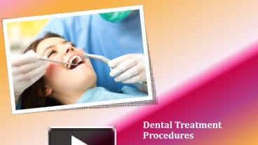 PPT – Dental Treatment Procedures PowerPoint Presentation | Free To ...