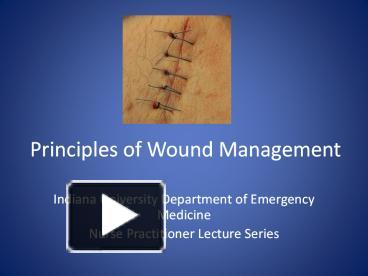 PPT – Principles Of Wound Management PowerPoint Presentation | Free To ...