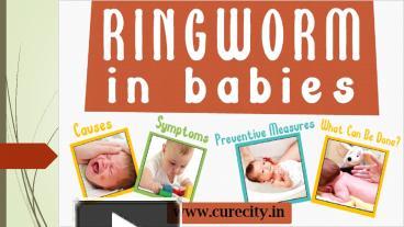 PPT – How To Treat Ringworm In Babies - Curecity PowerPoint ...