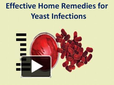 Infection throbbing yeast Yeast Infection