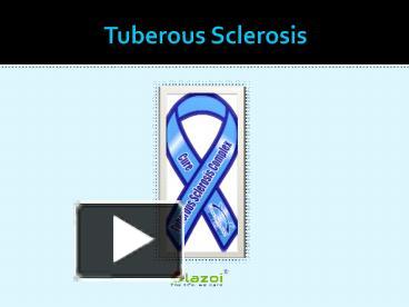 PPT – Tuberous Sclerosis: Overview Of Symptoms, Causes And Treatment ...