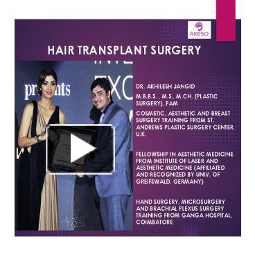 PPT – Hair Transplant In Delhi PowerPoint Presentation | Free To ...