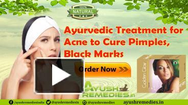 Ppt Ayurvedic Treatment For Acne To Cure Pimples Black Marks