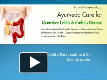 PPT – Ulcerative Colitis | Ulcerative Colitis Treatment – Bestayurveda ...