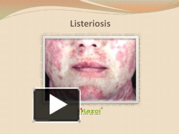 PPT – Listeriosis : Causes, Symptoms, Daignosis, Prevention And ...