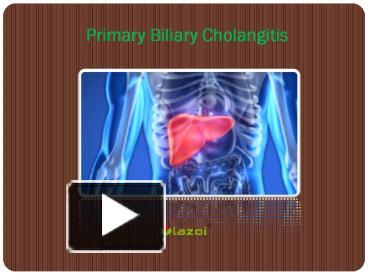 PPT – Primary Biliary Cholangitis: Causes, Symptoms, Daignosis ...