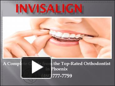 PPT – Types And Treatment Process Of Invisalign By Ooli Orthodontics ...